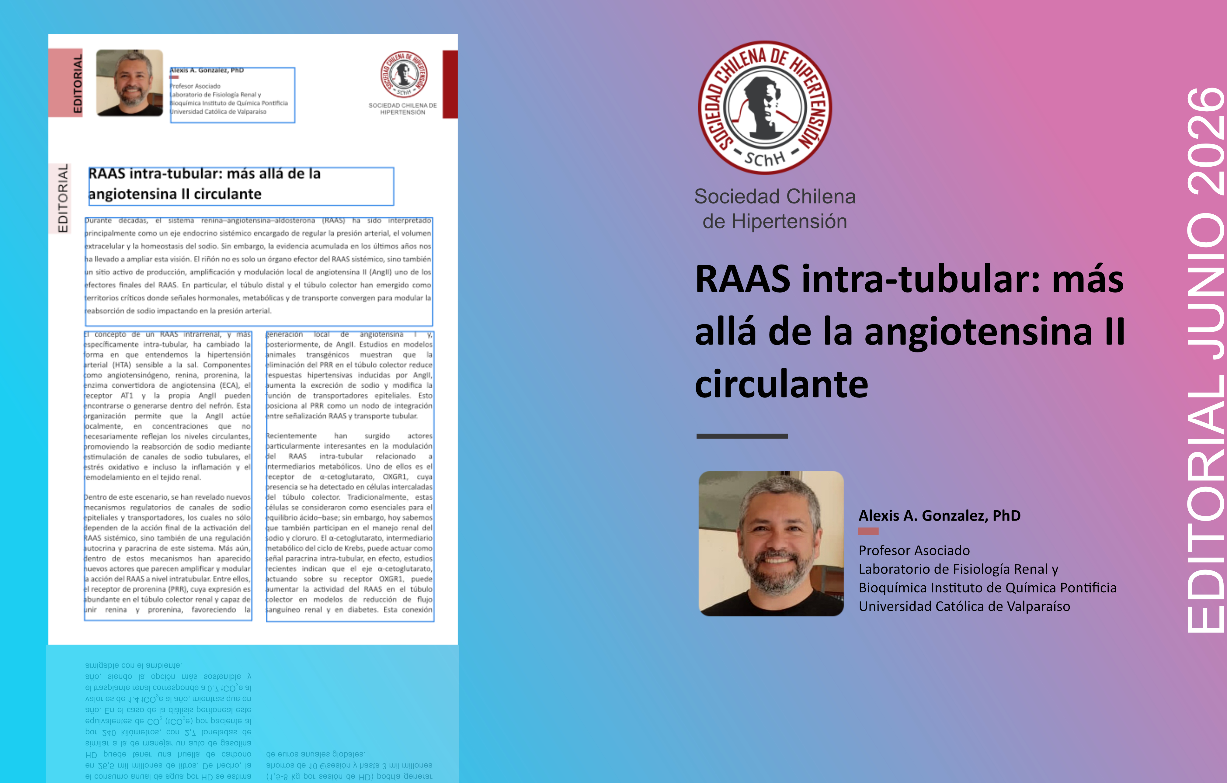 RAAS intra-tubular: más allá de la angiotensina II circulante.